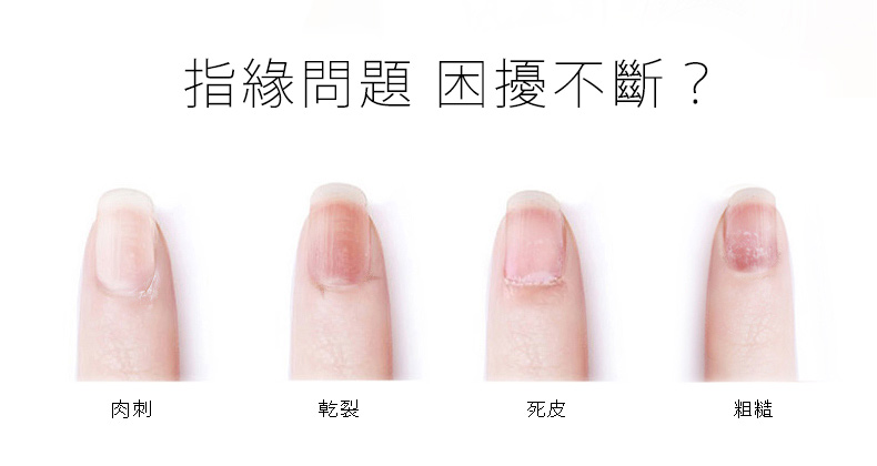 指緣問題困擾不斷 Nail Library指藝圖書館
