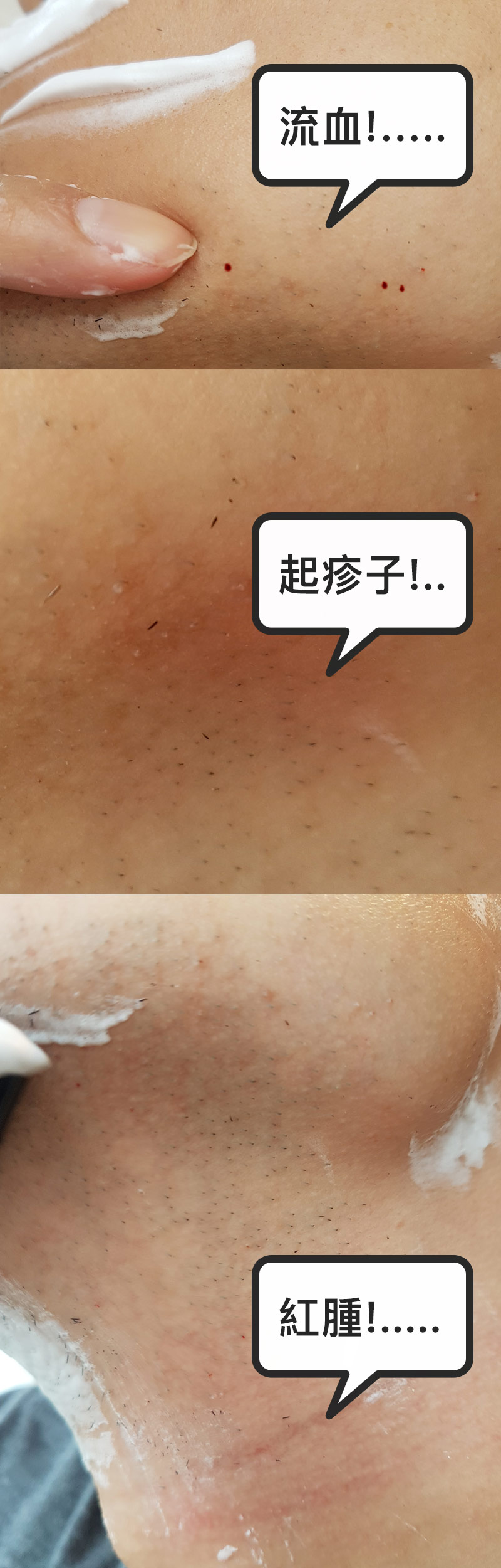 拒絕刮鬍刺激 痘痘肌與敏感肌刮鬍好友 Philips U Tube S566戰鬥機電鬍刀 飛利浦台灣官方直購體驗